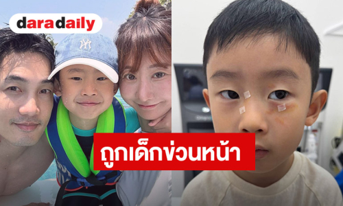 “อ้วน รังสิต” จุกอก! ลูกชาย “น้องโรฮา” ถูกเด็กข่วนหน้าในสวนสนุก