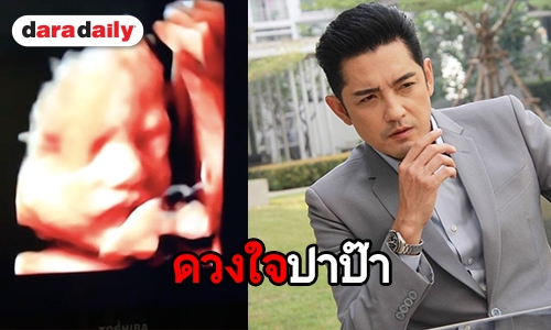 “ศรราม” อัพเดทพัฒนาการ บอกเลย “น้องวีจิ” แข็งแรงมาก