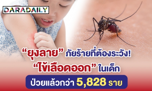 “ยุงลาย” ภัยร้ายที่ต้องระวัง! “ไข้เลือดออก” ในเด็ก ป่วยแล้วกว่า 5,828 ราย