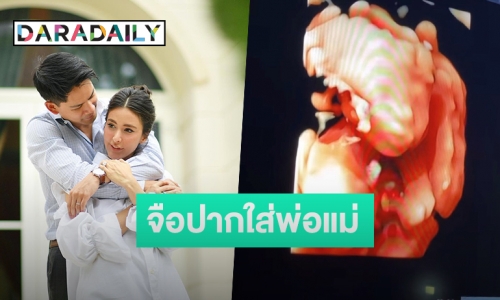 “กรณ์ ณรงค์เดช” เผยภาพอัลตร้าซาวด์ลูกในท้อง “ศรีริต้า” 