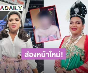 ออกมาสวยแน่! อัปเดทใบหน้า “พระมหาเทวีเจ้า” หลังศัลยกรรมได้ 2 วัน