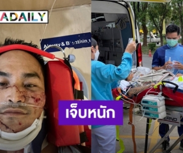 “สงกรานต์” เผยภาพครั้งแรกสภาพตอนเกิดอุบัติเหตุ ชาวเน็ตคอมเมนต์ให้กำลังใจ