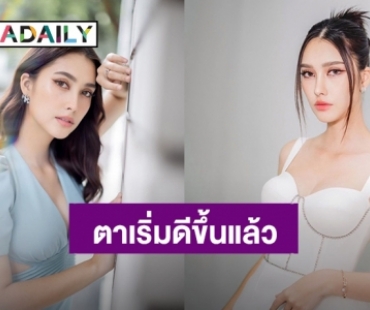 “ฮาน่า ลีวิส” ขอบคุณทุกความห่วงใย อัปเดตอาการกระจกตาถลอกตอนนี้เริ่มดีขึ้นแล้ว