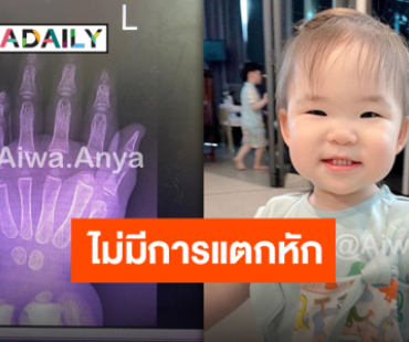 “หม่ามี้ออย” แจ้งอาการ “น้องอัญญา” หลังถูกประตูหนีบนิ้วนางข้างซ้าย ปลอดภัยหายห่วง