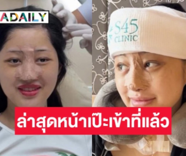 เปิดหน้าใหม่ “มิ้วกี้ ไปรยา” หลังถูกหมอดูทักทำแล้วปังมาก