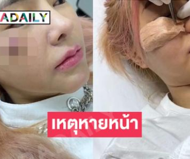 ไอดอลดังเผยเหตุหายหน้าไปจากยูทูปเพราะเหตุติดเชื้อตัวนี้