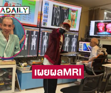 ไลฟ์สดกับแพทย์เผยผลMRI ของศิลปินป่วยตุ่มน้ำพองครั้งแรก