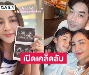 “ครูก้อย” ภรรยา “เจมส์” ย้อนเล่าเส้นทางท้องยากมีภาวะ PCOS