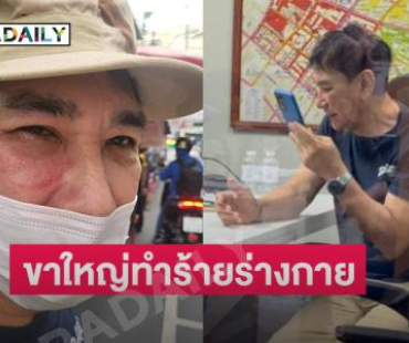 ด่วน! นักแสดงรุ่นใหญ่ ถูกขาใหญ่ย่านคลองถมทำร้ายร่างกาย ตาแตก หน้าบวมปูด ล่าสุดเข้าแจ้งความแล้ว