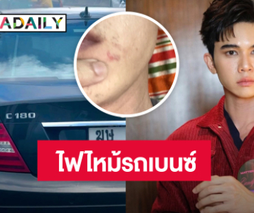 “ป๊อบ คำเกษม” ลุ้นระทึก! ไฟไหม้รถเบนซ์ เกือบเอาชีวิตไม่รอด
