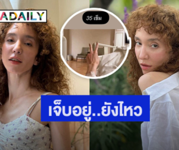 เจ็บแต่ไหว! “คลาวเดีย” ประสบอุบัติเหตุ วูบล้มหัวฟาด! เย็บ 35 เข็ม