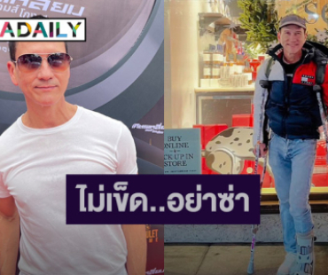 ไม่เข็ด! “น้อย วงพรู” ขำไอดอลตกเวทีกระดูกหักบ่อย รับหมอเตือนอย่าซ่า