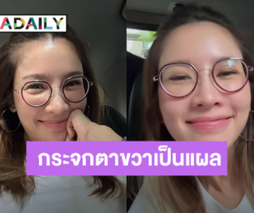 “ไบรท์ พิชญทัฬห์” พักสายตาชั่วคราว กระจกตาขวาเป็นแผล