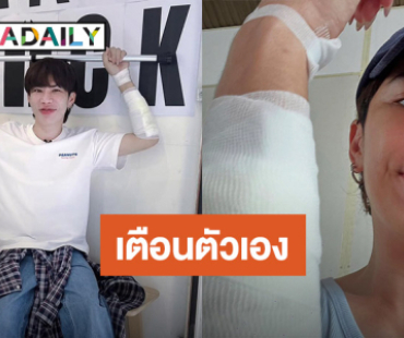 เตือนตัวเอง! “เอม วิทวัส” เล่าเกิดอุบัติเหตุรถล้ม อย่าประมาท