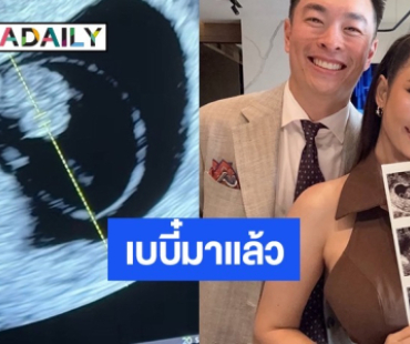 “ปาย สิตางศุ์” โพสต์ภาพอัลตร้าซาวด์ประกาศข่าวดี เบบี๋มาแล้ว
