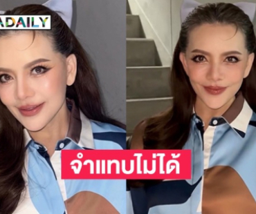 ส่องภาพล่าสุด “หนูแหม่ม สุริวิภา” หลังศัลยกรรมทำหน้าเด็ก