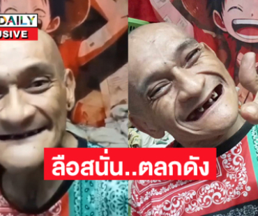โต้ข่าวลือเสียชีวิต!!ตลกดังเดินไม่ได้แล้ว