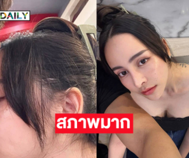 สภาพมาก “จ๊ะโอ๋ งามพริ้ง”  หลังทานตี๋น้อยเสร็จ