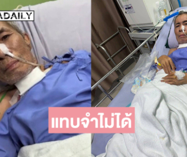 น่าตกใจตลกดังป่วยหนักเห็นภาพแทบจำไม่ได้