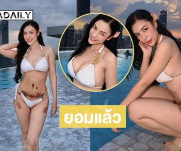 ซุปตาร์มิสแกรนด์เสิร์ฟทูพีชร้อนฉ่าทั่วโซเชียล